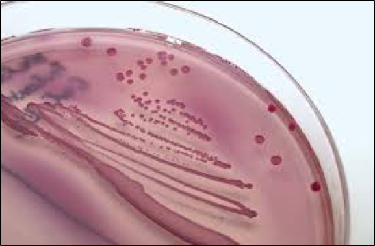 blood in urine microscopy